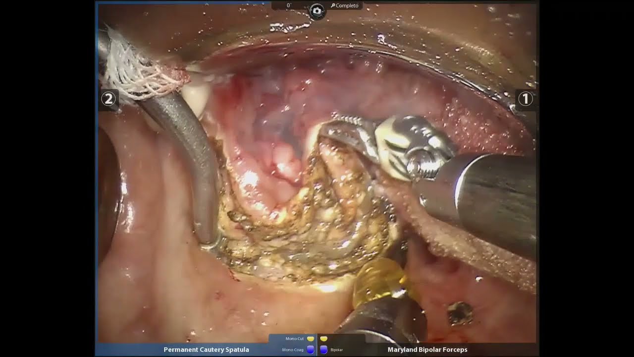 Adriano Santana Fonseca-16