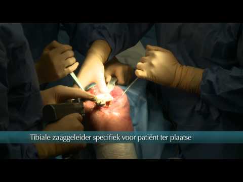Bandage am Ellenbogen kaufen Wund Taille Fettleibigkeit