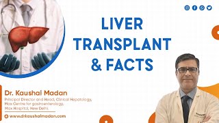 Download Lagu Liver Transplant| Facts| Dr Kaushal Madan |Director u0026 Head | Best| Hepatologist| Gastroenterology Thumbnail