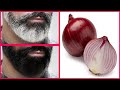 White Beard To Black Naturally Permanently With Red Onion 100 Working At Home