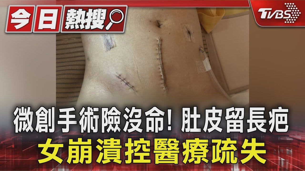 微創手術險沒命! 肚皮留長疤 女崩潰控醫療疏失