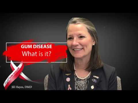 Video preview: What is gum disease? by Dr. Joseph Nemeth