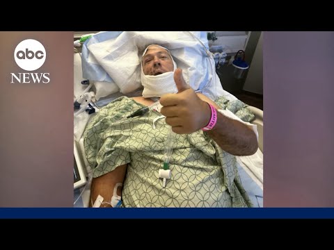 Bear attack survivor: ‘I knew my jaw was gone’