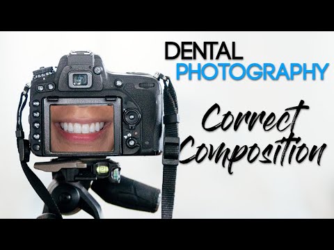 Dental Photography Basics - How to Take a Quality Dental Photo - Correct Composition