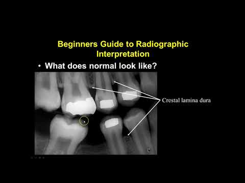 Oral Radiology- Principles and Interpretation Video