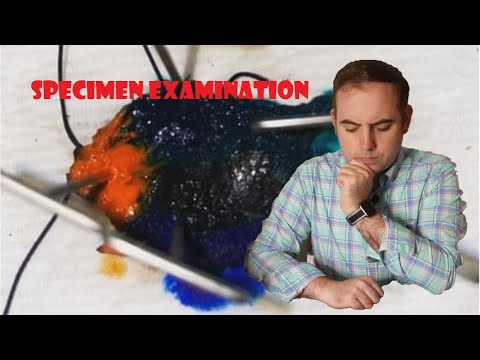 Gross (Macroscopic) Exam of a Tongue Tumor (Small Squamous Cell Carcinoma)