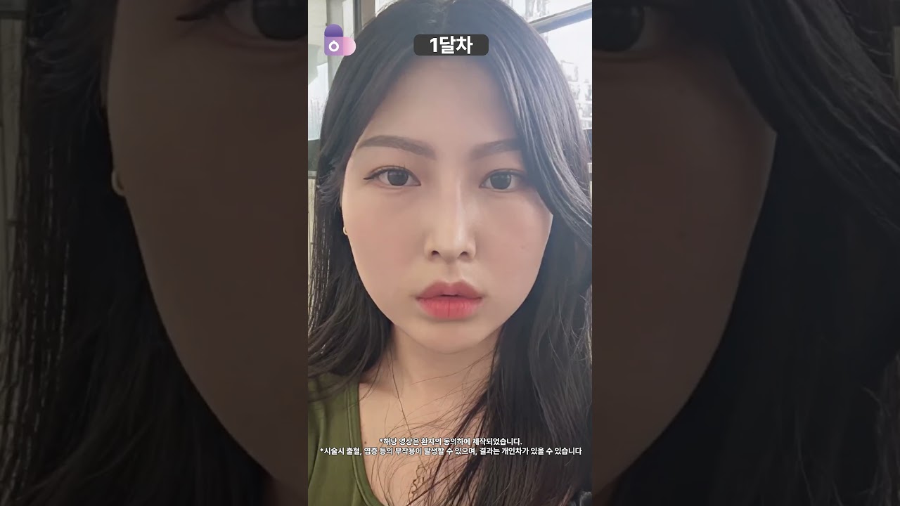 고양이상? 눈이 아닌 '코 라인'!