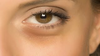how to get rid of bags under eyes for men easy