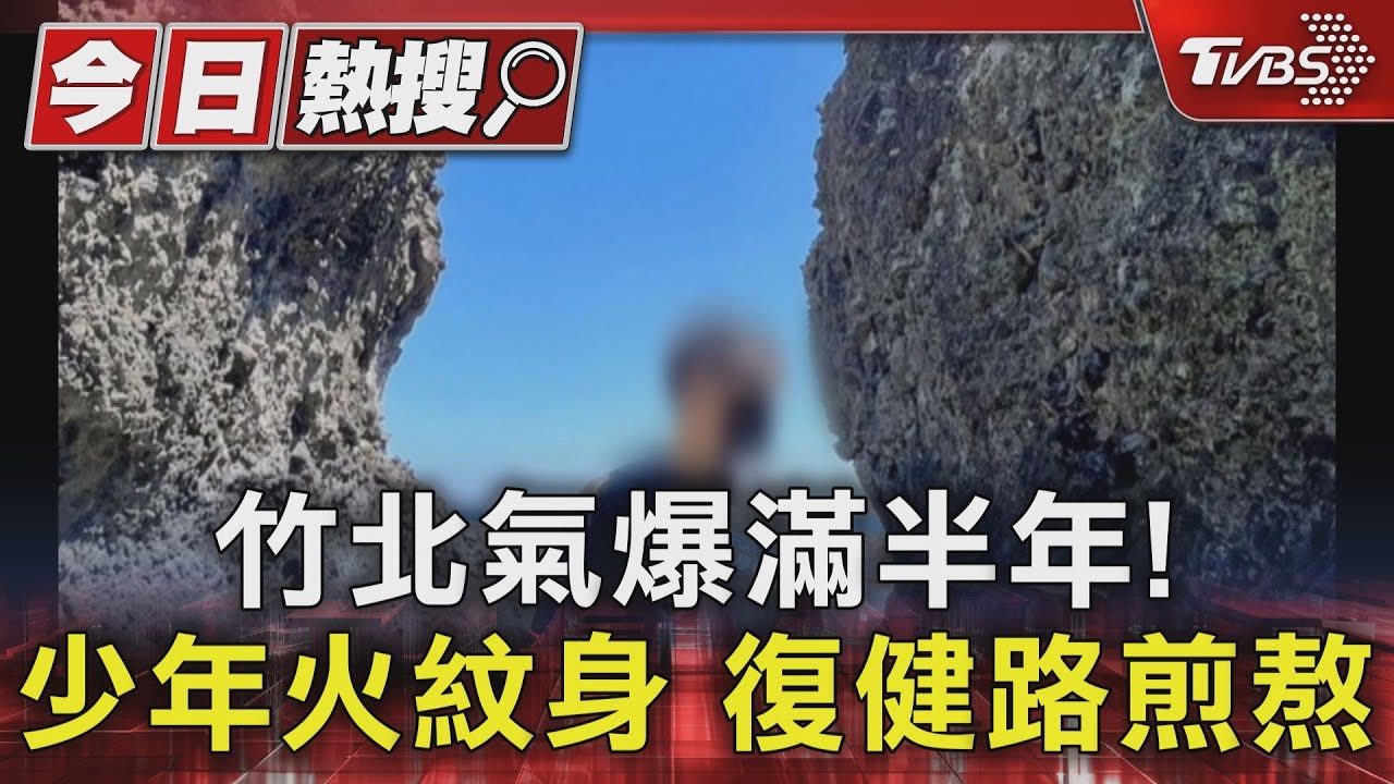 竹北氣爆滿半年！少年火紋身　復健路煎熬