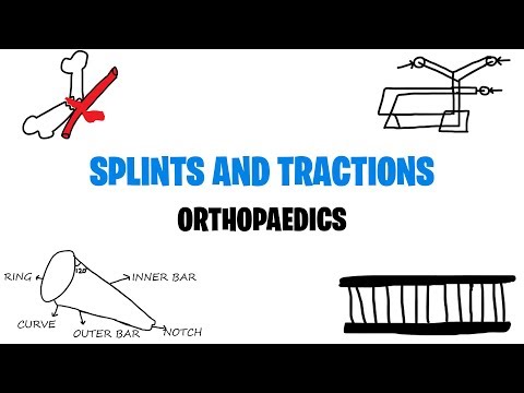 SPLINTS AND TRACTIONS | ORTHOPAEDICS | MED VIDS MADE SIMPLE