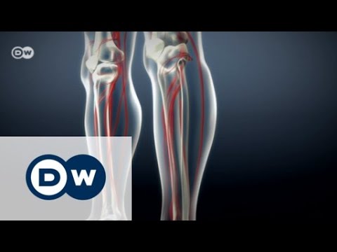 Darsonval crown Prostatitis Bad für Potenz und Prostatitis