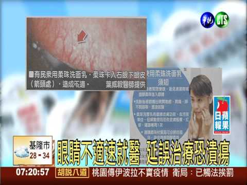 洗面乳柔珠卡眼皮 女罹結膜炎