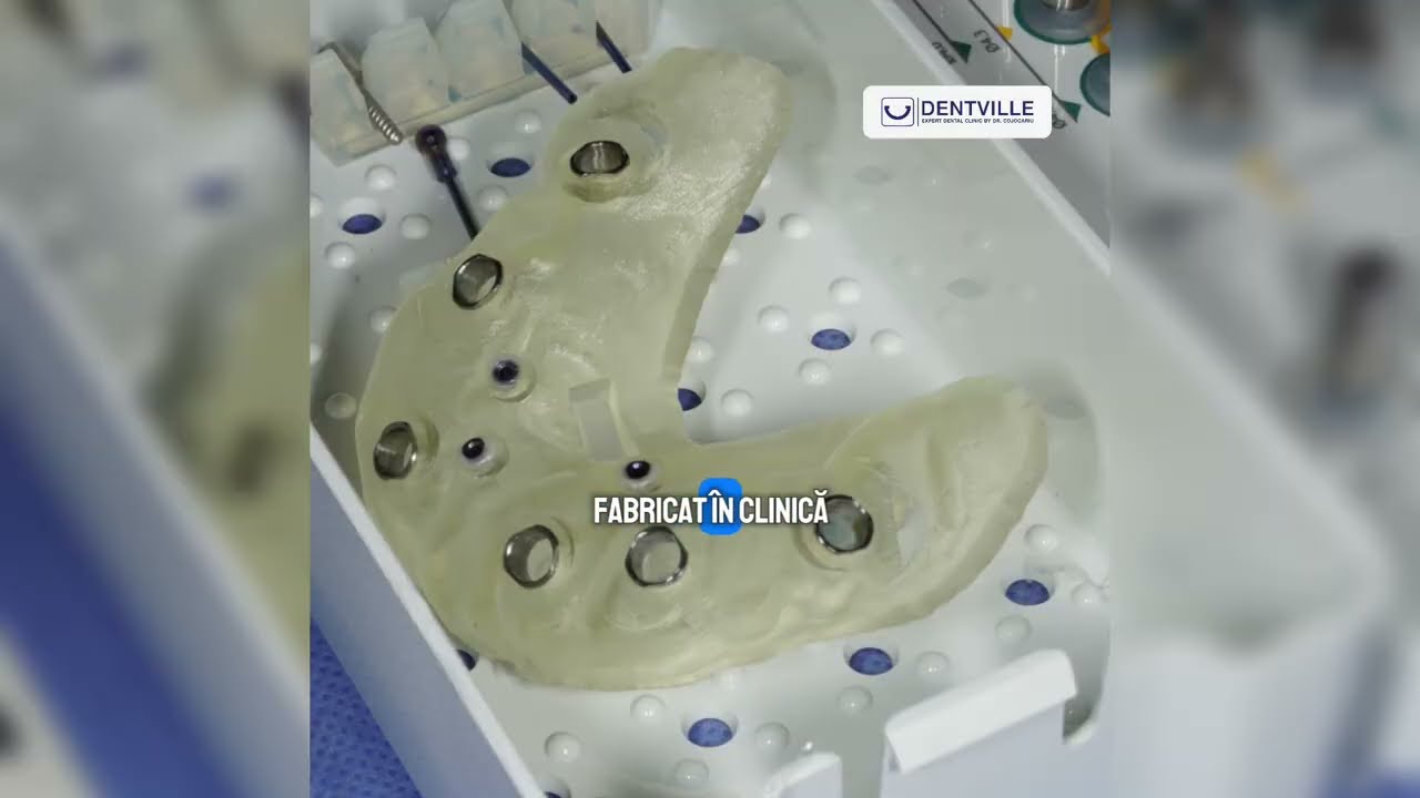 <div style="text-align: left; white-space: normal; overflow: hidden; display: -webkit-box; -webkit-line-clamp: 2; -webkit-box-orient: vertical; line-height: 1.3em;">Ce este un ghid chirurgical și din ce este făcut? | Un mic dispozitiv dar cu un rol uriaș</div>