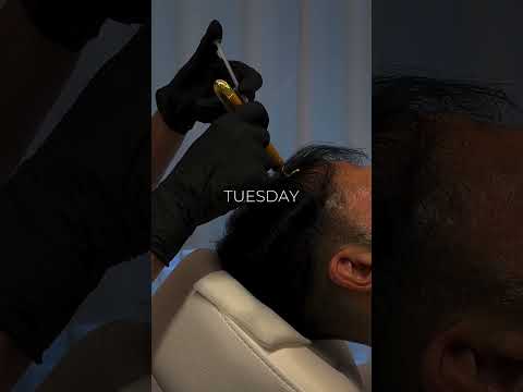 Santé Clínica Estética Barcelona