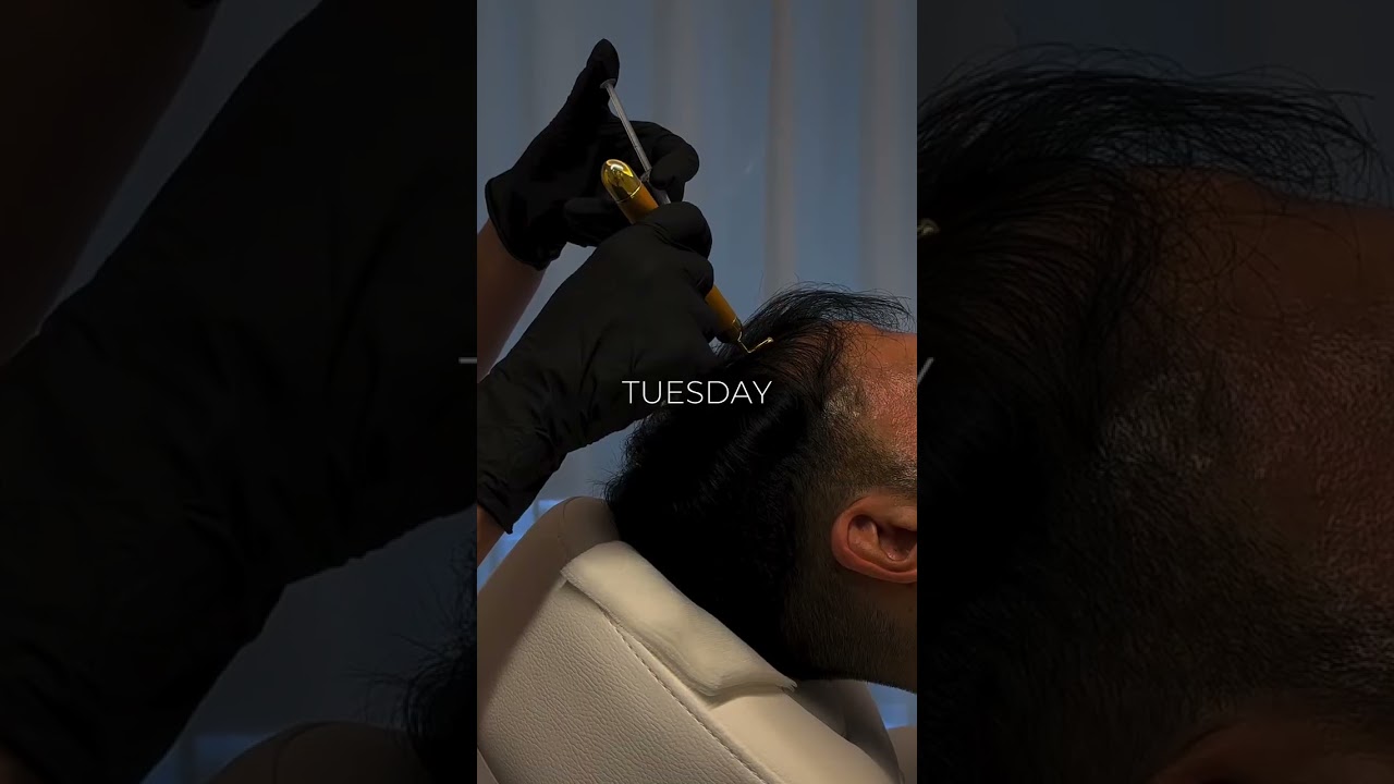 Santé Clínica Estética Barcelona