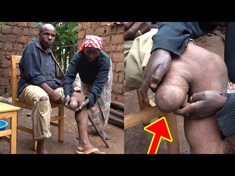 Bullies Call him a Man with Two Sexes | BORN DIFFERENT