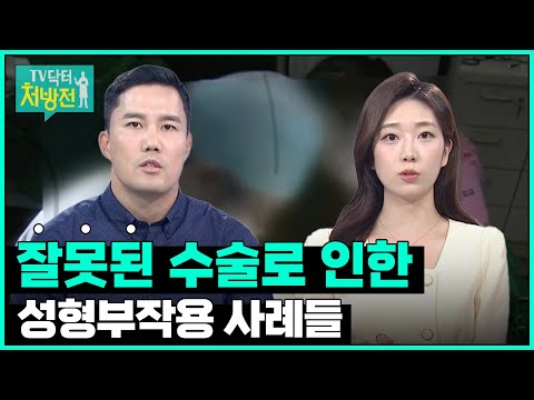 [TV닥터처방전] 성형부작용