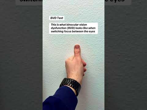 This is what binocular vision dysfunction (BVD) can look like when switching focus between the eyes!