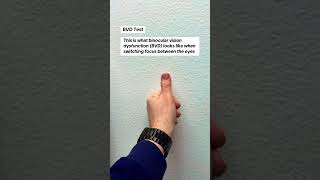 This is what binocular vision dysfunction (BVD) can look like when switching focus between the eyes!