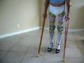 Blue Brace 2