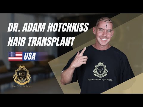 Hair Transplant in Turkey | Dr. Adam Hotchkiss Hair Transplant Review | Hair Center of Turkey