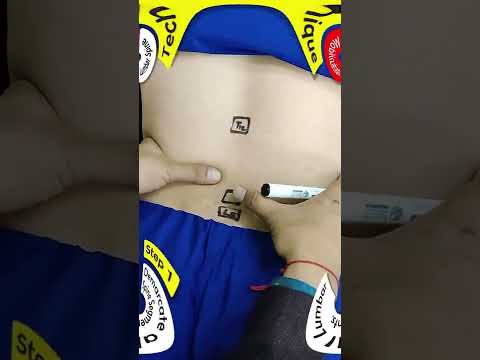 TMJ MOBILIZATION TECHNIQUES FOR JAW PAIN STIFFNESS SHORTS REELS