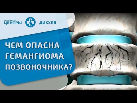 Почему болят суставы ног у подростка Боли в суставах после операции по удалению яичников