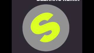 Bingo Players - When I Dip (Bezhang Remix)