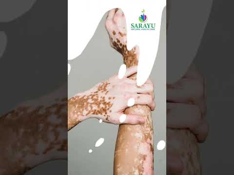 Heal the natural way! 🌿 Discover the power of Ayurveda at Sarayu Natural Health Care