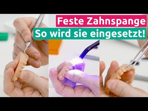 Feste Zahnspange! So wird sie in den Mund eingesetzt!