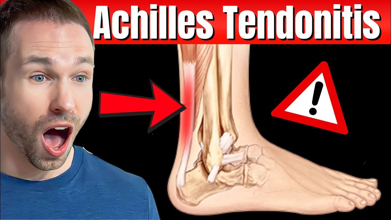 How to Fix Achilles Tendonitis: Evidence-Based Methods to End Pain