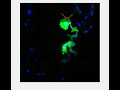 Melanoma Cells With NGFR Tagged With Split MNeonGreen2