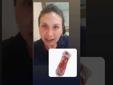 Menstruação com coágulos! Muito fluxo. #medical #saude #saúde #medico #fluxo #menstruação