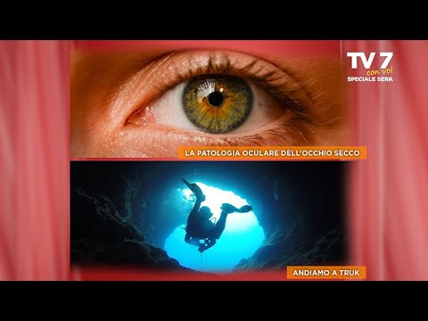 TV7 CON VOI SPECIALE SERA DEL 8/2/22 (3 di 6) - La patologia oculare dell'occhio secco