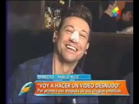 Intrusos-Pablito Ruiz después de su cirugia estética última parte