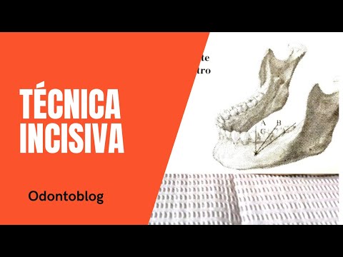 Técnica incisiva