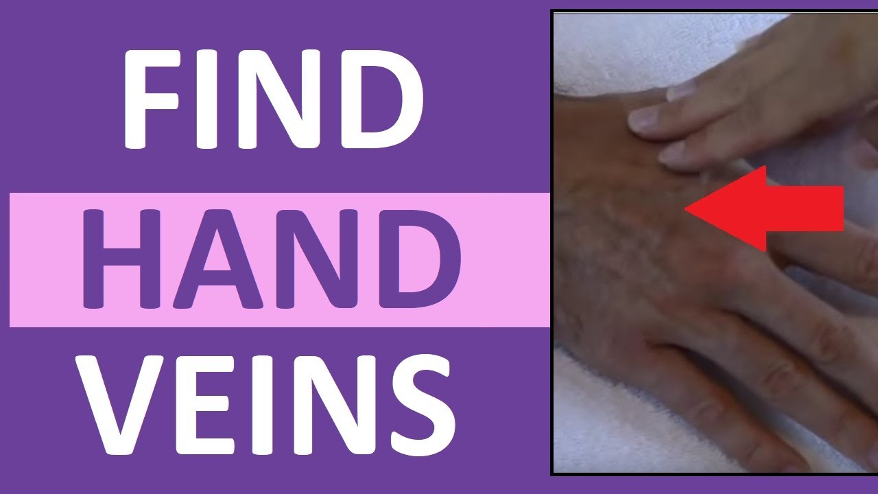 How to find a Vein in the Hand for Starting IVs & Drawing Blood