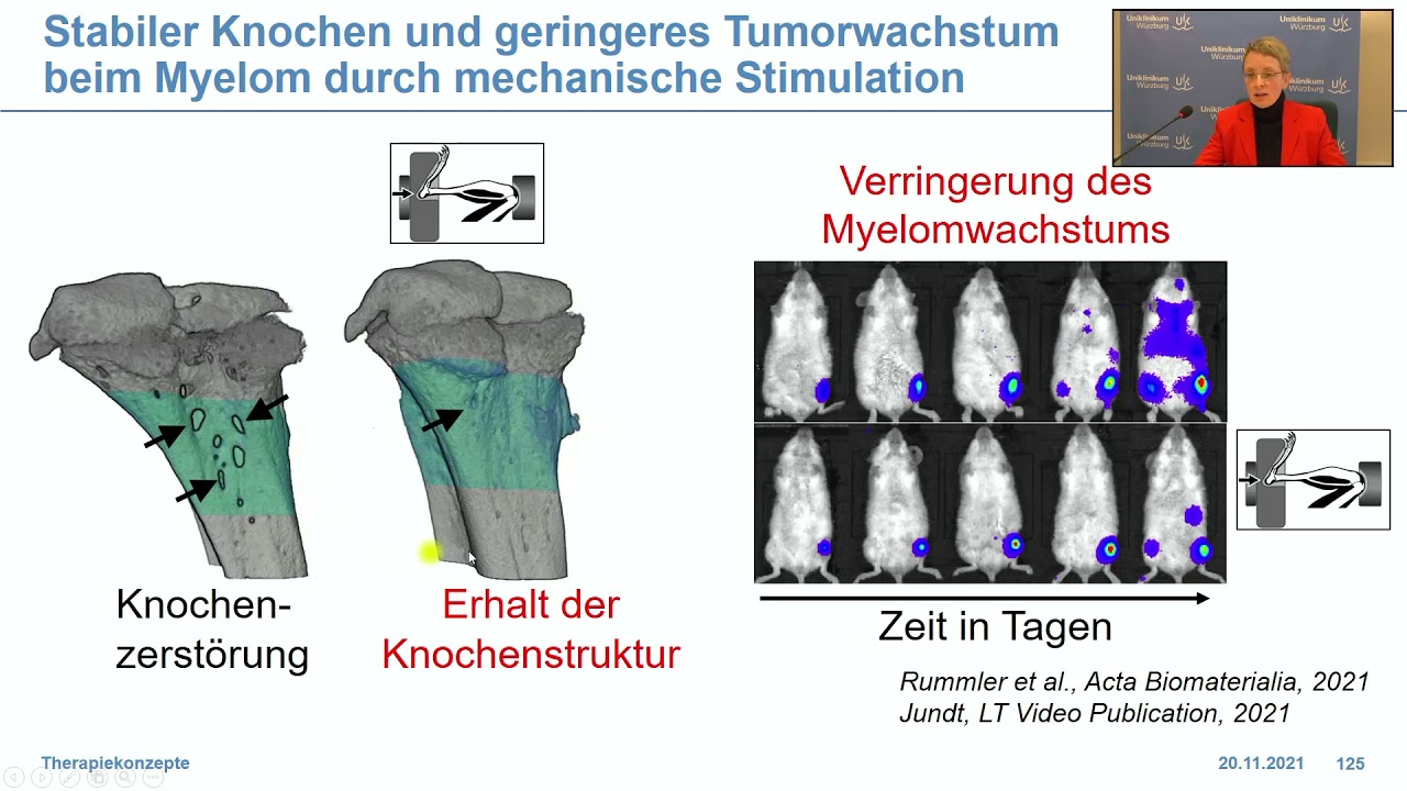 4. Digitale Myelom-Forum Prof. Dr. med. Franziska Jundt