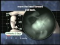 Window on the Womb: 9 to 11 Weeks 