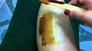preview picture of video 'Hair Removal With Strip It Sugaring Wax (Epilating Unwanted Hairs)'