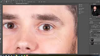 Removing red veins in the eyes in photoshop