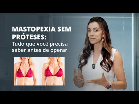 MASTOPEXIA: É POSSÍVEL REALIZAR SEM O USO DE PRÓTESES?