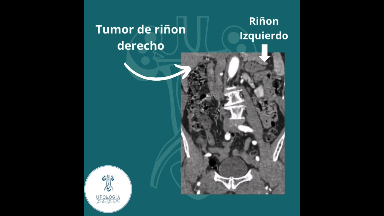 Said De La Paz Martinez-12