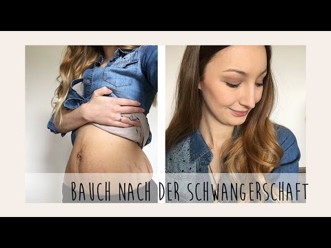 Das Ekzem auf dem Foto das Anfangsstadium die Behandlung Die Schuppenflechte des Kopfes nicht hormonal