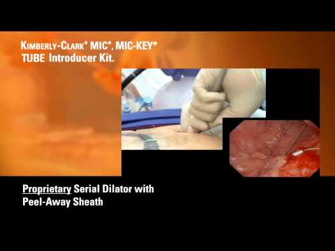 Kimberly-Clark* MIC*/ MIC-KEY* Laparoscopic Introducer Kits