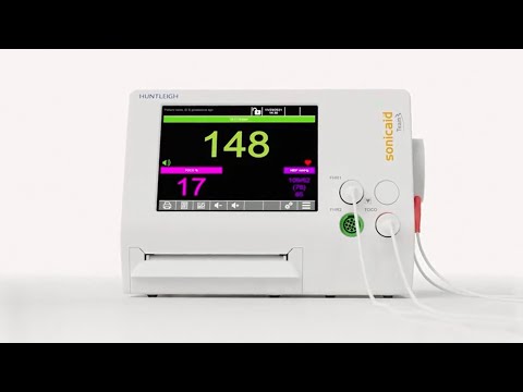 Sonicaid Team3 - Advanced Fetal Monitoring for the Next Generation