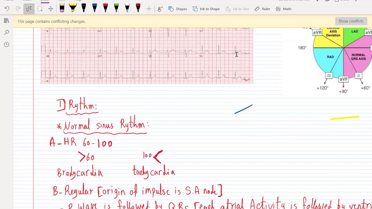 ECG Part 2 for USMLE Step 1 and Step 2 CK - (Free trial course in Description Below)