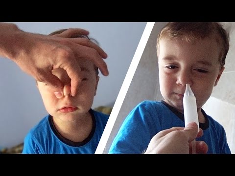 Nariz Entupido do Bebê Semi-Adulto com Congestão Nasal Video