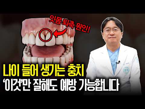 "단것 안 먹는데 왜?" 나이 들수록 충치 폭발하는 진짜 이유