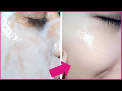 Настойки для отбеливания лица Удаление пигментных пятен лазером фото
